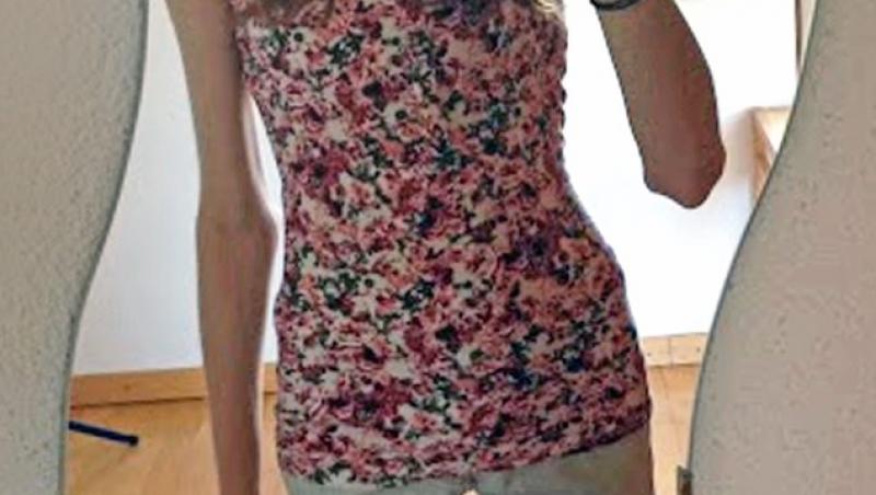Chiara Schober , selfie in oglinda, pe vremea cand era anorexica