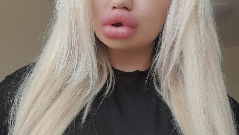 Andrea Ivanova, femeia cu cele mai mari buze din lume, vrea să aibă buzele și mai mari. Ce au averizat-o medicii