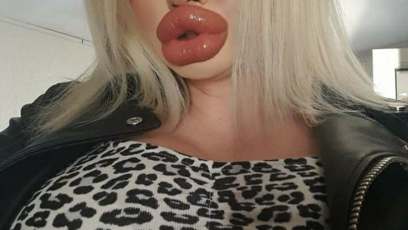 Andrea Ivanova, femeia cu cele mai mari buze din lume, vrea să aibă buzele și mai mari. Ce au averizat-o medicii