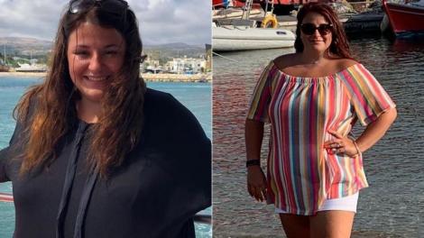 Femeia care a fost criticată pentru că era obeză a slăbit 50 kilograme. Cum arată acum și cât au costat procedurile