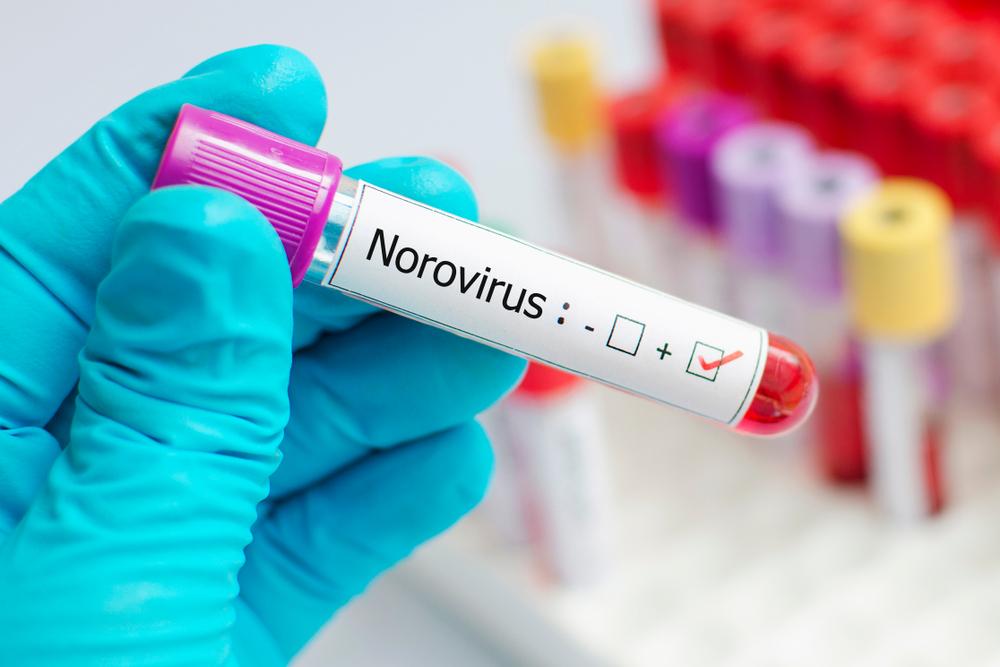 analize de sange care arata ca persoana sufera de norovirus
