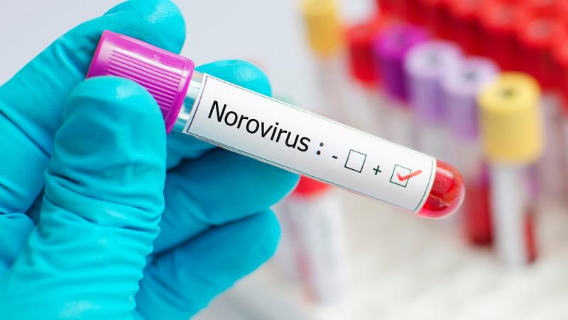 analize de sange care arata ca persoana sufera de norovirus