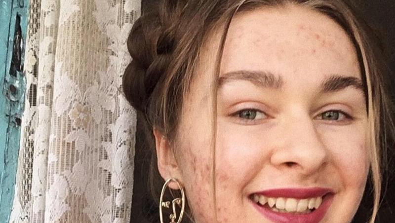 Tânăra din Ucraina a arătat tuturor ce a pățit după ce nu a mai mâncat ciocolată