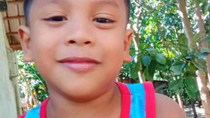 Băiatul din Filipine a supraviețuit în mod miraculos deși glonțul i s-a înfipt în craniu