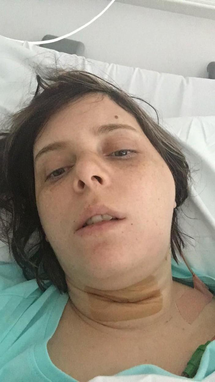 holly strevens, femeia care a mancat burger si a ajuns la spital (poza dupa de operatie)