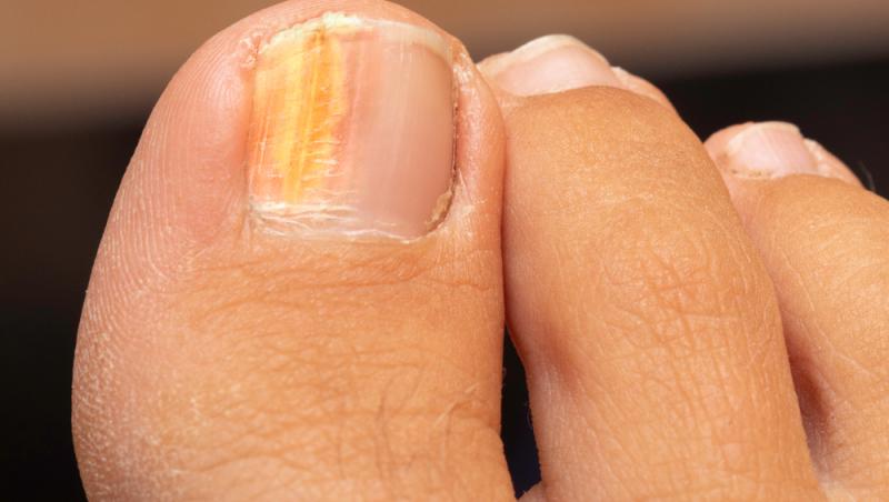 Culoarea unghiilor tale de la picioare dezvăluie adevărul despre starea ta de sănătate. Ce spun specialiștii
