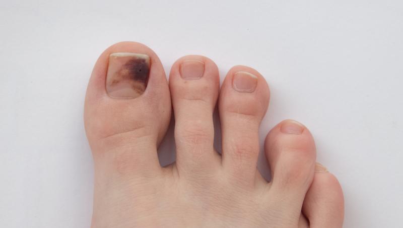 Culoarea unghiilor tale de la picioare dezvăluie adevărul despre starea ta de sănătate. Ce spun specialiștii