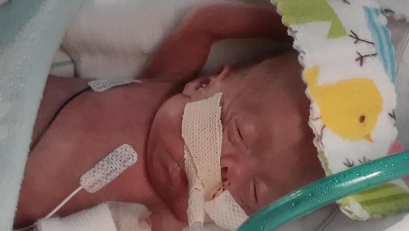 Cel mai mic bebeluș prematur din lume a împlinit un an, deși medicii au fost rezervați. Cum arată acum Richard Hutchinson