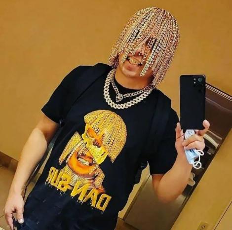 Dan Sur este primul rapper din lume care și-a făcut implant cu lanțuri de aur pe scalp în locul firelor de păr. Cum arată