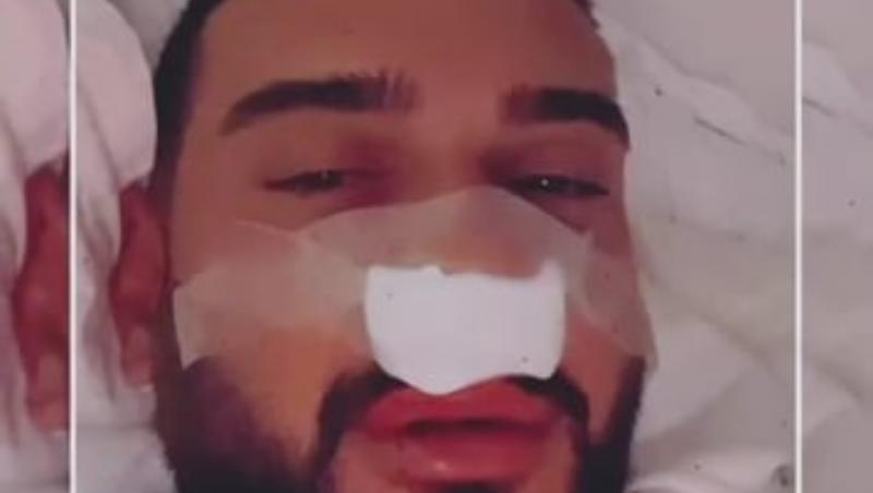 Dorian Popa s-a operat la nas din cauza unei probleme de sănătate. Care este starea artistului după intervenție