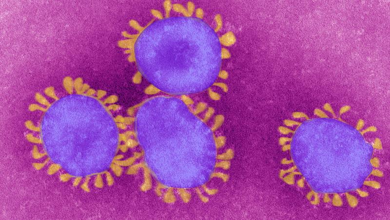 Ce simptome are “Deltacron”, noua variantă a coronavirusului descoperită. Este o mutație hibrid depistată în Cipru