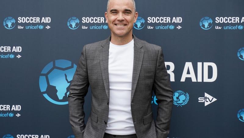 Robbie Williams este îngrijorat că va rămâne fără podoaba capilară, după ce tratamentele au dat greș