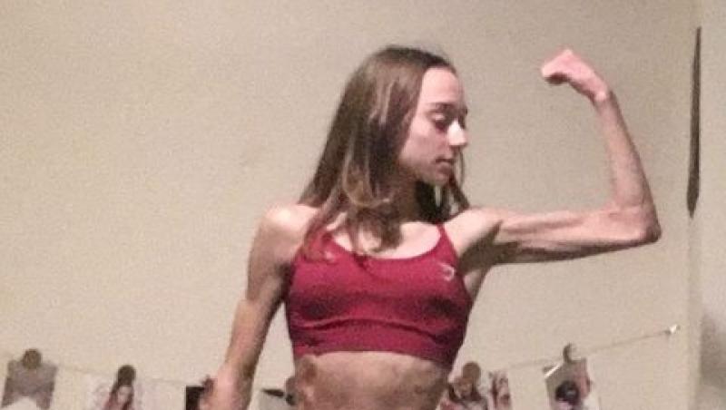 Femeia care a trecut de la anorexie la culturism. Cât s-a transformat corpul ei și cum arată acum
