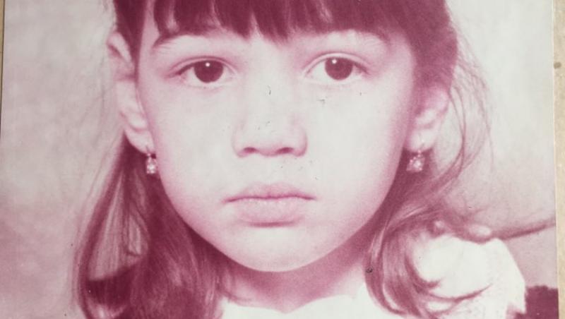 Anna Shepard, femeia care a început să albească de la vârsta de 13 ani. Cum arată acum