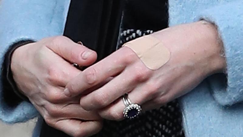 Motivul pentru care Kate Middleton are mai mereu un deget bandajat. Detaliul neașteptat dezvăluit de experți