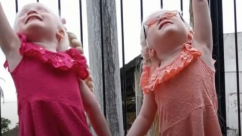 Cum arată acum primii gemeni cu albinism din Argentina care au uimit pe toată lumea. Fetele cu părul alb ca zăpada au făcut 4 ani