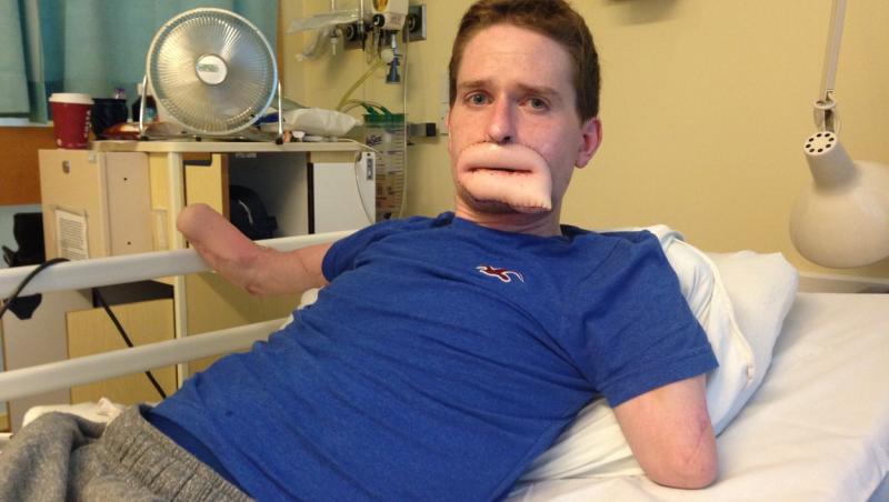 Alex Lewis a crezut că suferă de “gripa bărbatului”, dar când a ajuns la spital medicii l-au pus în fața unei vești dificile