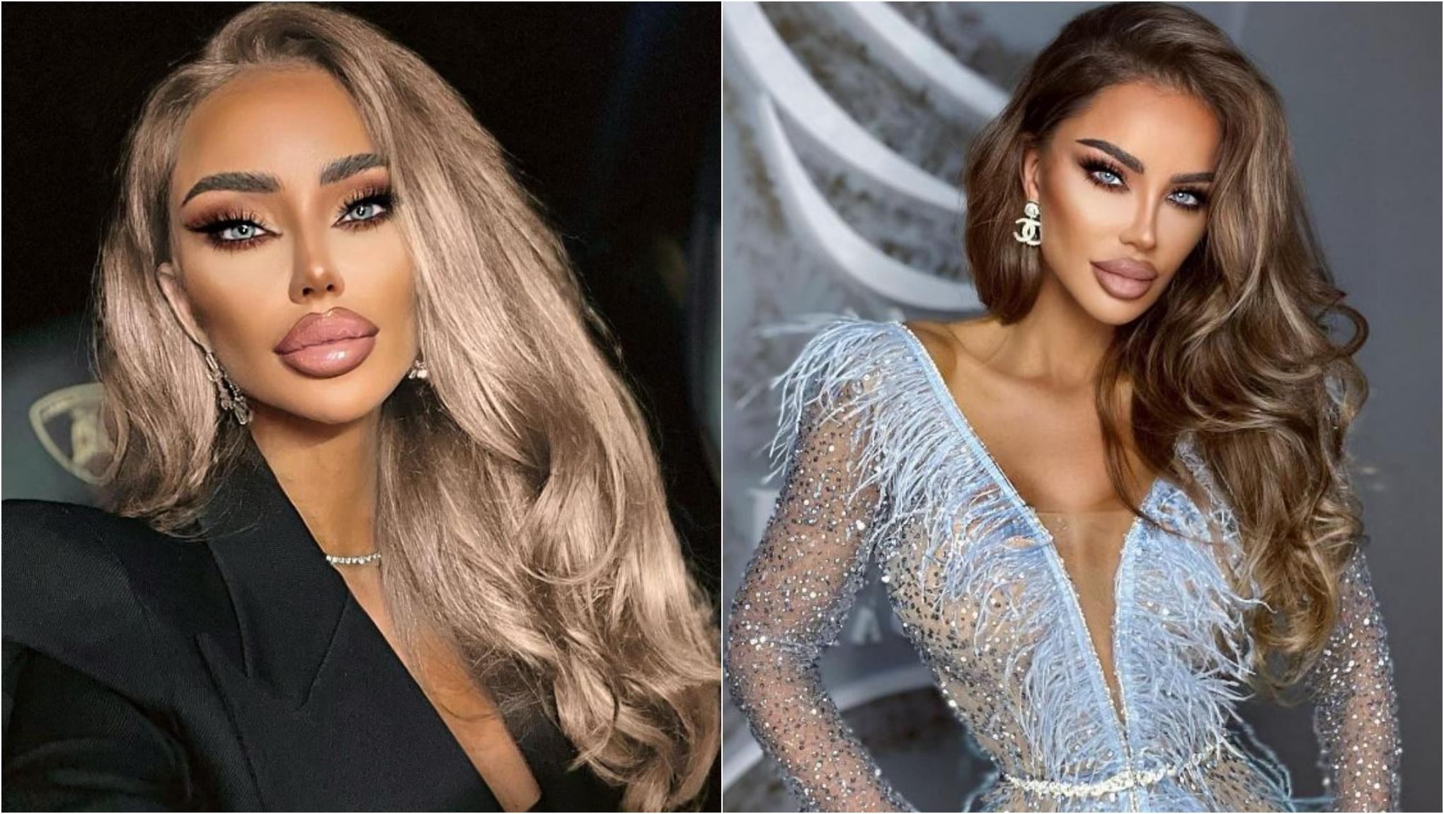 Bianca Drăgușanu a ajuns de urgență la spital, cu fața umflată. Ce s-a &icirc;nt&acirc;mplat cu frumoasa vedetă