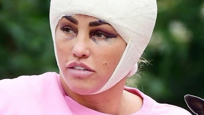Katie Price a apărut bandajata la cap în urma unei intervenții estetice. Diva este o împătimită a operațiilor