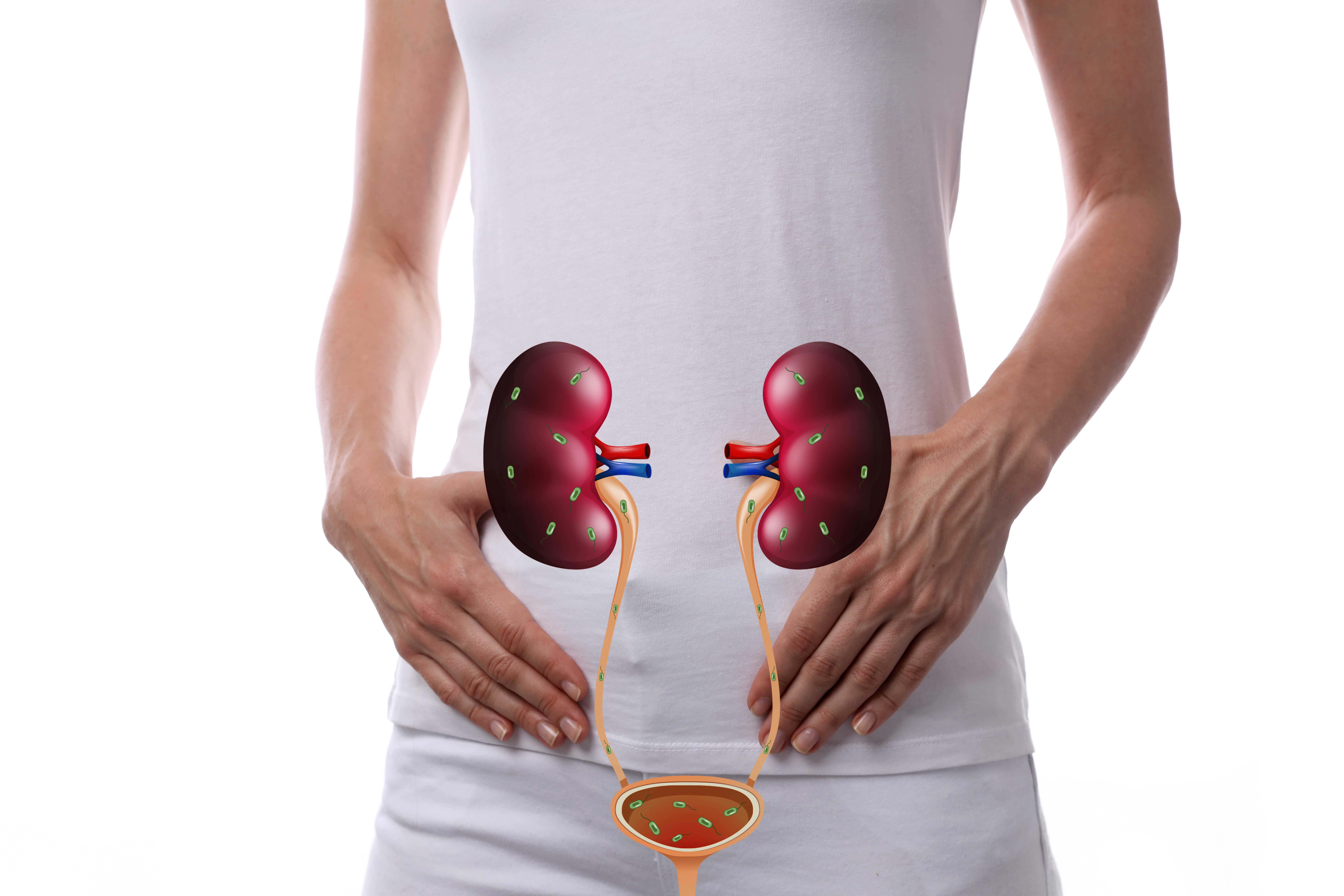 poza standard cu rinichi  afectati d einfectii urinare