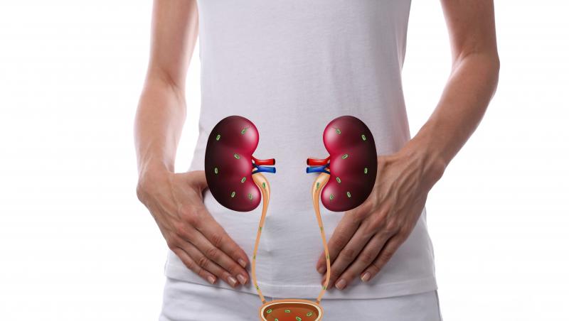 poza standard cu rinichi  afectati d einfectii urinare