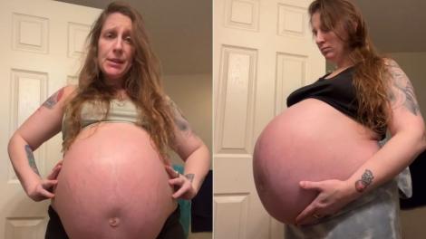 O femeie însărcinată în 37 săptămâni arată de parcă urmează să nască 8 bebeluși. Care e explicația