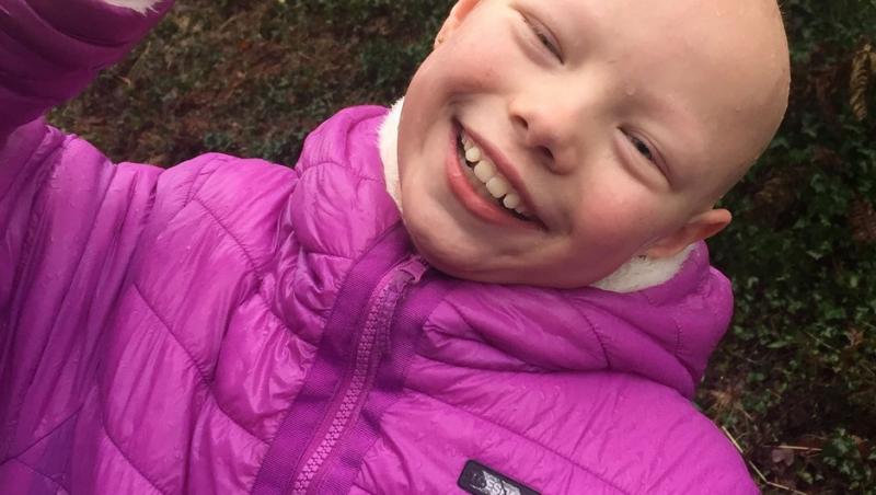 Fetița în vârstă de 8 ani care suferă de alopecie a demonstrat că e optimistă, în ciuda diagnosticului. Ce job și-a găsit
