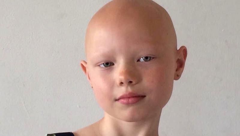 Fetița în vârstă de 8 ani care suferă de alopecie a demonstrat că e optimistă, în ciuda diagnosticului. Ce job și-a găsit