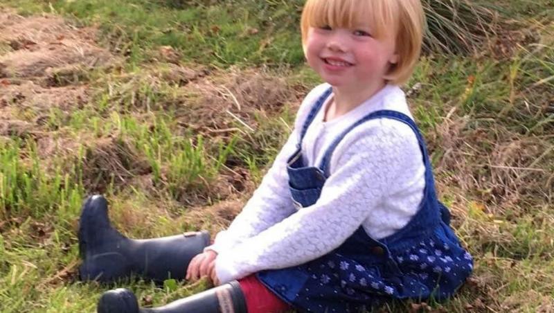 Niamh Lewis, o fetiță în vârstă de 8 ani din Glyncorrwg, Wales era perfect sănătoasă la naștere și avea capul acoperit de păr, însă până la vârsta de 5 ani părul ei a început să cadă.