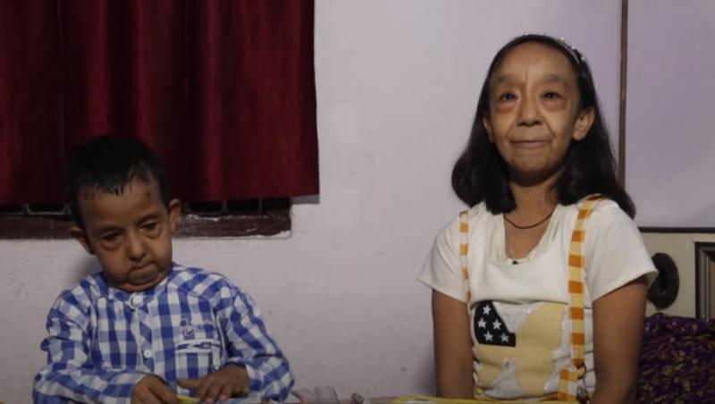 Keshav și Anjali Kumar, doi frați tineri din Jharkhand, India, suferă de două afecțiuni rare cunoscute sub numele de Cutis Laxa și Progeria, care îi fac să pară incredibil de bătrâni pentru vârsta lor.