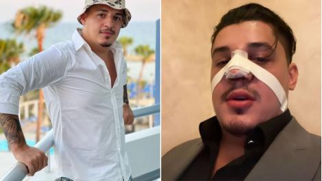 Bogdan de la Ploiești a apărut cu nasul bandajat pe rețelele sociale. Ce a pățit artistul de manele