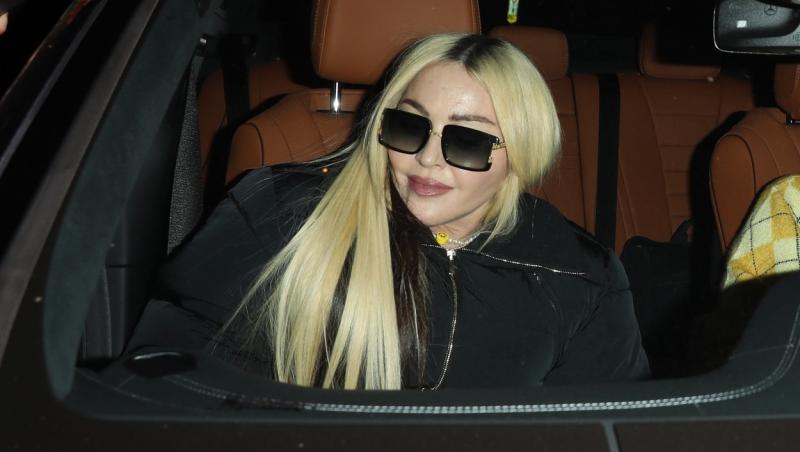 Madonna a recurs la mai multe intervenții la nivelul feței ar în mediul online folosește filtre de imagine