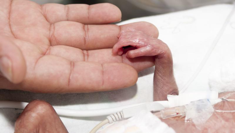 Ce au descoperit medicii care l-au îngrijit pe bebelușul prematur