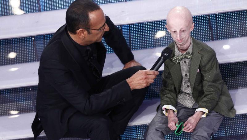 Sammy Basso este cea mai în vârstă persoană care suferă de Progeria. Cum arată