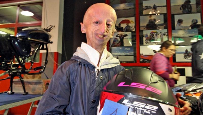 Sammy Basso este cea mai în vârstă persoană care suferă de Progeria. Cum arată