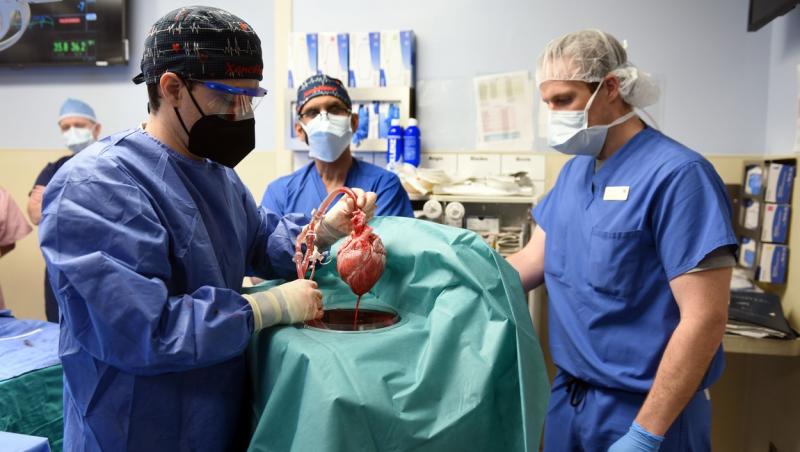 Bărbatul care a primit transplant de inimă de la un porc a decedat. Care a fost cauza decesului și ce spun medicii