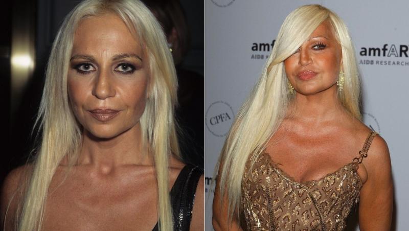 Donatella Versace, în vârstă de 67 ani, arată acum total schimbată după ce a apelat la numeroase intervenții estetice și nu toate au fost reușite.