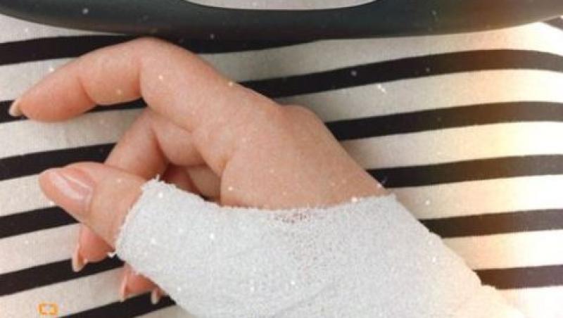 Gina Pistol și-a îngrijorat prietenii virtuali după ce a publicat o imagine cu mâna sa bandajată