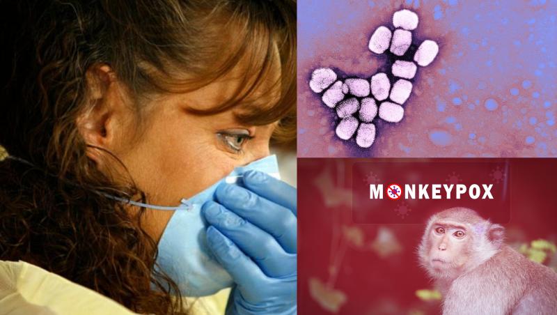 Virusul care provoacă variola maimuței a fost identificat până în prezent în peste 50 de ţări situate în afara Africii unde este endemic.