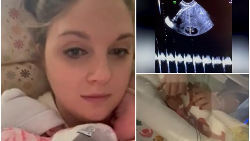 Imaginile cu cei doi copii prematuri au devenit virale
