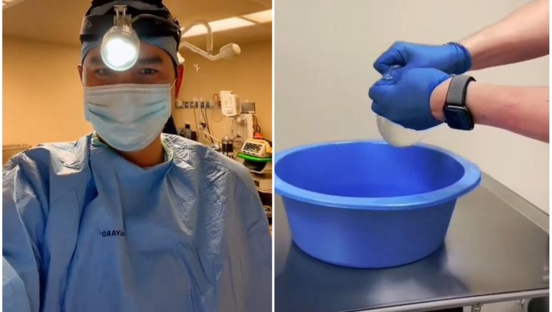 Doctorul a publicat imaginile cu implantul de silicon pe TikTok și acestea au devenit imediat virale
