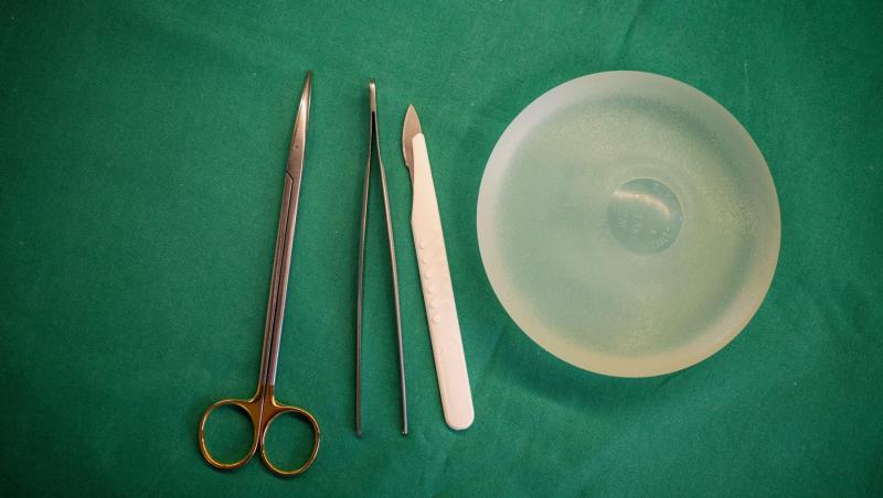 Ce a găsit un medic atunci când a scos un implant mamar de silicon, vechi de 30 de ani. Filmarea a devenit virală pe TikTok