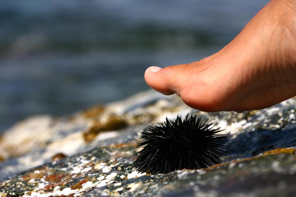 După rechini, aricii de mare sunt următorul pericol ce ne pândește la mare. Ce trebuie să facem ca să fim în siguranță