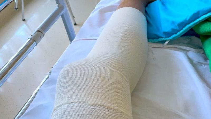 O tânără a crezut că are doar o urticarie la picior, dar când a mers la medic a primit un diagnostic crunt. Ce avea, de fapt