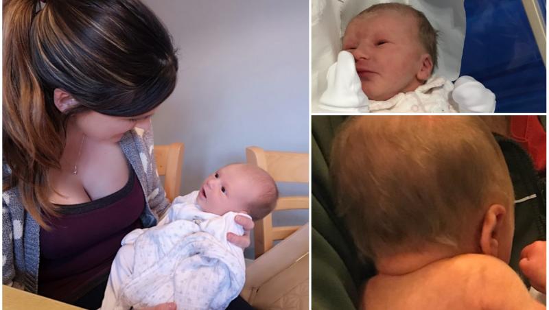 Abia la șase săptămâni după ce s-a născut, părinții au descoperit ce este în neregulă cu părul copilei