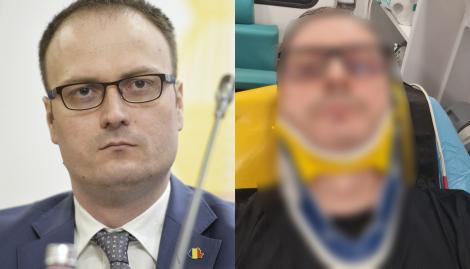 Alexandru Cumpănașu a ajuns la spital cu răni grave, după ce un bărbat a intrat frontal în mașină. Care este starea lui acum