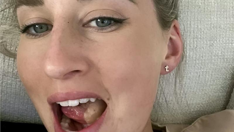 O tânără de 27 de ani avea ulcerații bucale și punea asta pe seama oboselii, dar când a mers la medic a primit un diagnostic crunt