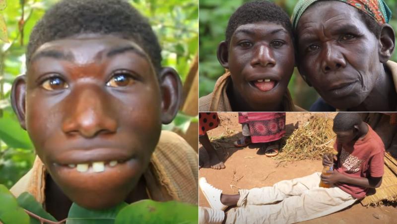 Zanziman Ellie din Rwanda, adesea supranumit „Mowgli din viața reală”, și-a petrecut cea mai mare parte a timpului în junglă, adesea agresat de localnici doar pentru că arăta diferit.