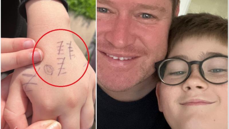 Bărbatul a pozat semnele de pe mâna băiatului și a arătat totul pe internet