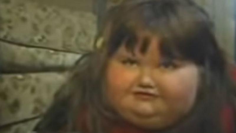 Cazul real al fetiței care a ajuns să cântărească 220 de kilograme la doar 7 ani. Mulți ani a consumat 10.000 de calorii zilnic